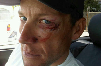 Tour de California: Caída de Lance Armstrong
